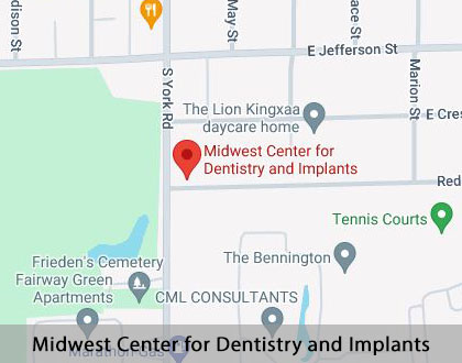 Map image for Options for Replacing Missing Teeth in Bensenville, IL